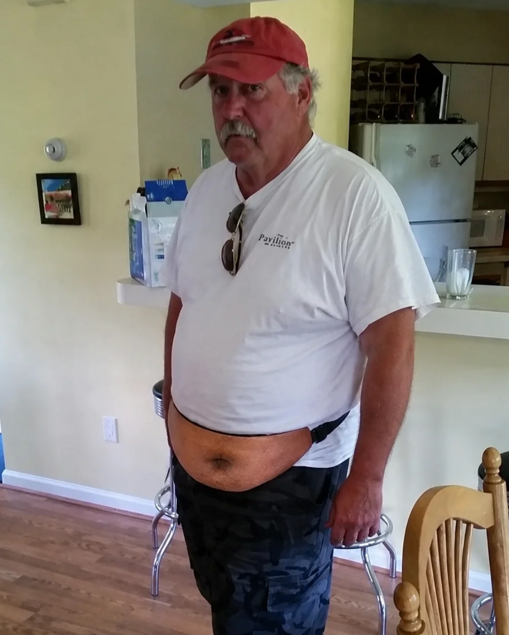Waist Bag