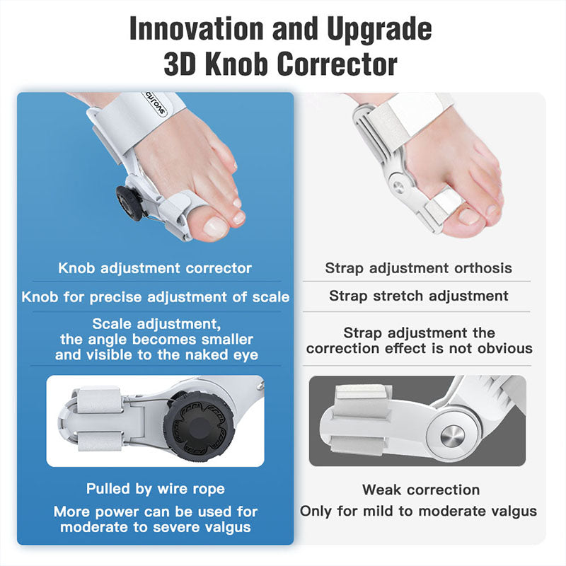 Upgraded Toe Bunion Corrector - 3D Knob Toes Corrector